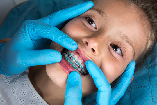 Orthodontist examining a little girl patient's teeth