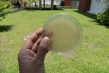 agar medium in petri dish for microbial plate count