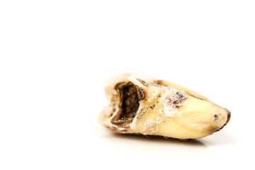 Decayed Tooth Isolated on White Background