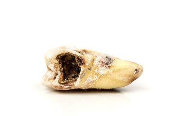 Obraz premium Decayed Tooth Isolated on White Background