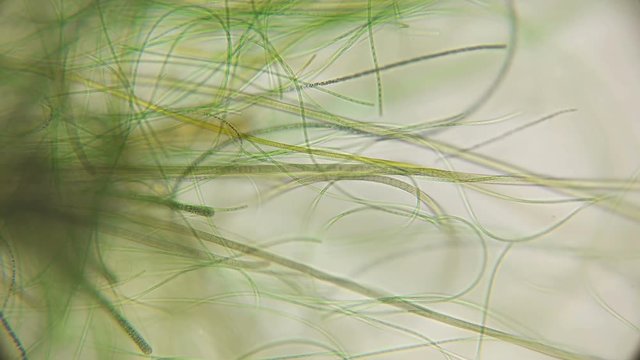 movement of live algae under a microscope, similar to the tentacles of the body, which is very exciting