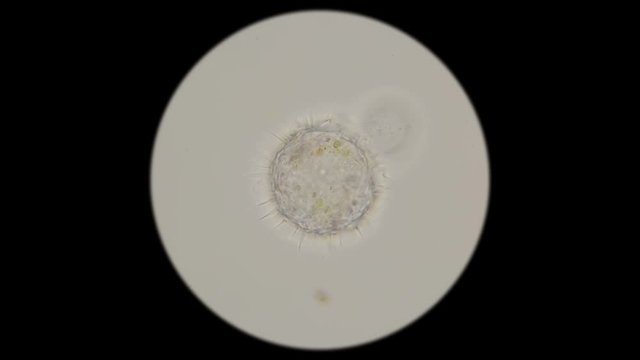 view of Rhizopoda under a microscope