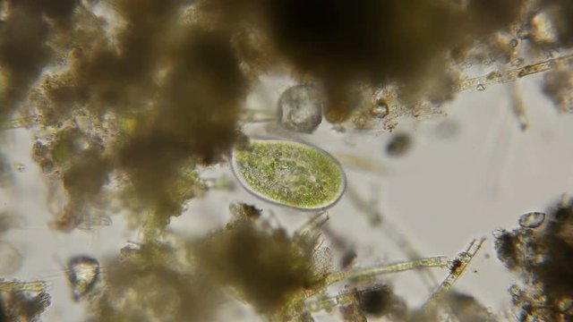 Paramecium bursaria protozoan under a microscope