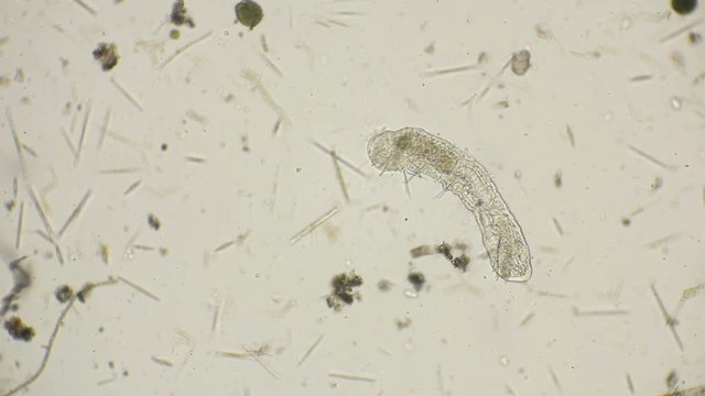 the simplest microorganism worm under a microscope