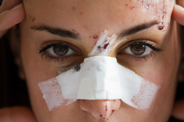 girl victim of accident or violence