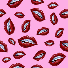 Illustration with lips and braces. Seamless pattern on a pink background.