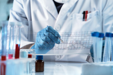 researcher reading a graph of the results of the analysis / doctor analyzing the statistics chart...