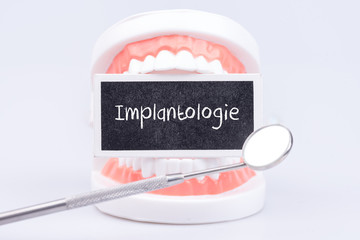 Fototapeta Implantologie beim Zahnarzt obraz