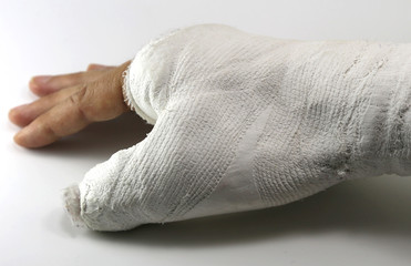 hand in the emergency room after the fracture of the thumb due t