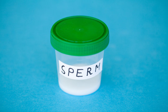 Health. Close up Concept of Bank Sperm. Infertility Bank with Sperm. Doctor's Hand Holds Container for Analyzes. Sperm Analysis on Blue Background.
