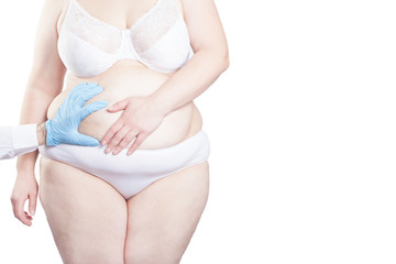 Doctor marking stout woman's belly for plastic surgery. Weight loss concept