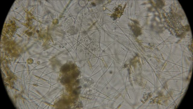 colony infusoria shoe under a microscope