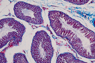 Human testis under the microscope view.