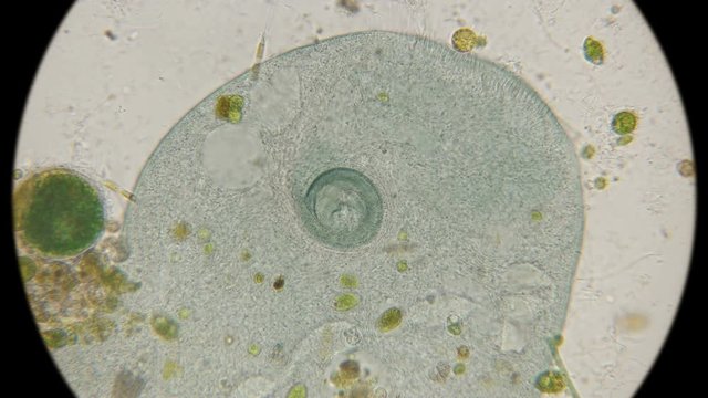 buccal cavity infusorians Stentor coeruleus under a microscope
