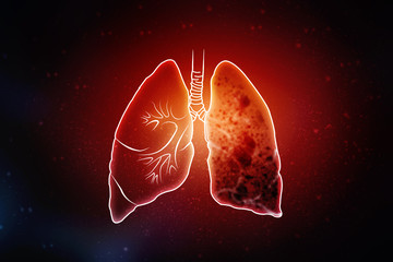 2d illustration Tuberculosis Day
