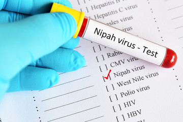 Blood sample tube with laboratory requisition form for Nipah virus test
