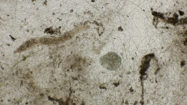 movement of the worm oligochaet under the microscope
