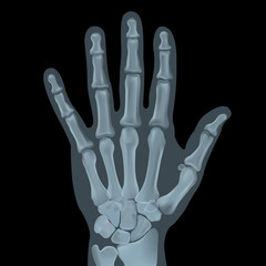 Realistic x-ray shots.Image uses a grid gradient.