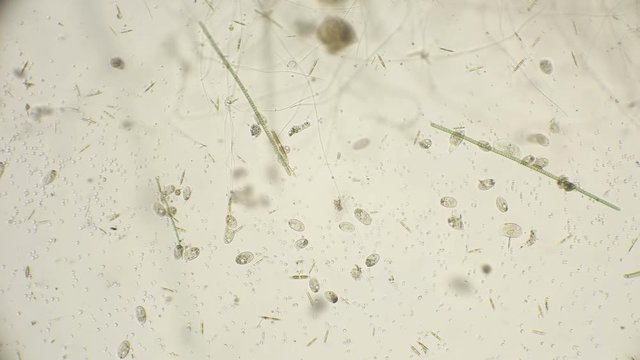 colony infusoria shoe under a microscope