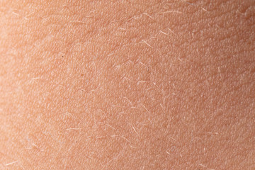 A white man's skin as a background