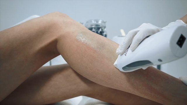 Doctor performing laser hair