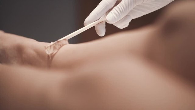 Doctor performing laser hair