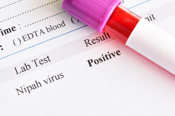 Positive result of Nipah virus test with blood sample tube