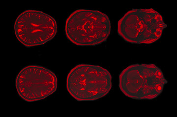 X-ray image of the brain computed tomography