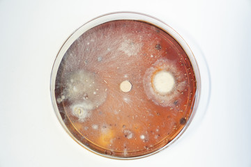 Petri dish with colonies of bacteria