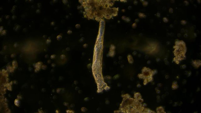 rotifer - microorganism under microscope