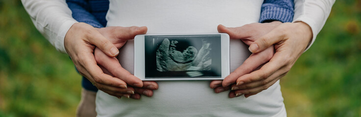 Man showing ultrasound of his son on the mobile over his wife's belly