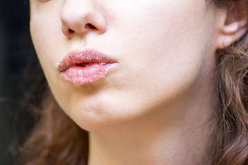 Strawberry lip scrub made at home to exfoliate lips 