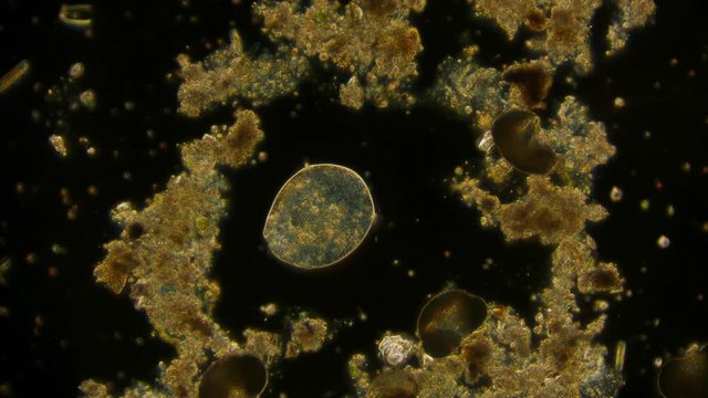 ciliate - microorganism under microscope