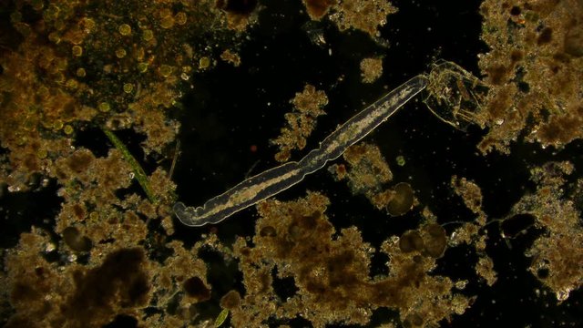 nematoda - microorganism under microscope