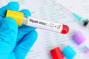 Blood sample tube positive with Nipah virus test