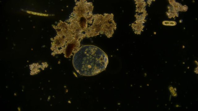 ciliate - microorganism under microscope
