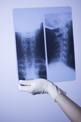Medical xray spine neck scan
