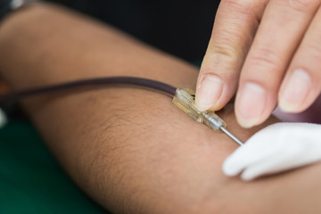 Health and Medical : Nurses use fingers press needles pierce vein in arm for blood donation. Blood donation occurs when voluntarily has blood drawn used for transfusions. World blood donor day June 14