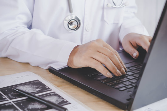 female doctor hand typing on computer laptop checking on the file information of patient with x-ray medical picture on desk 
