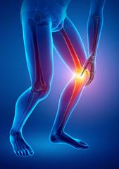 Male Knee pain