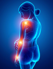 Women Feeling Arm joint pain