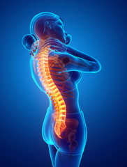 Women Feeling the Back pain