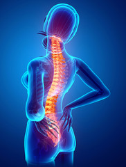 Women Feeling the Back pain