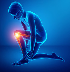 Male Knee pain