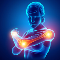 Women Feeling Arm joint pain