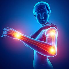 Women Feeling Arm joint pain