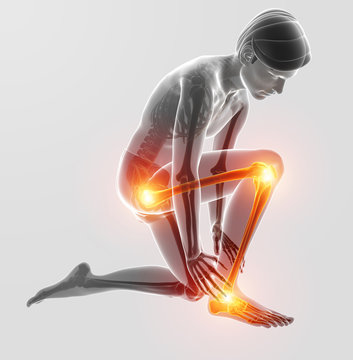 3d Illustration of Pain in leg