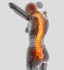 3D Illustration of Female Feeling the back pain