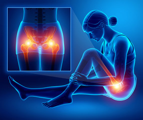 3d Illustration of Female with Hip pain