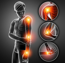 3d Illustration of Men Feeling Arm joint pain